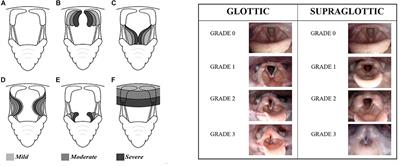 Exercise Induced Laryngeal Obstruction in Humans and Equines. A Comparative Review